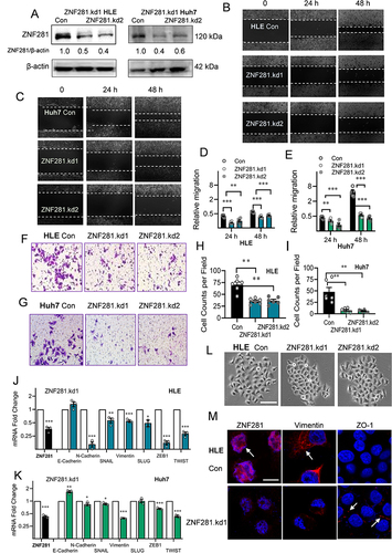 Figure 2 Knockdown of ZNF281 inhibited migration and invasion in HCC cells with retardation of EMT. (A) Western blot of ZNF281 in shRNA (ZNF281.kd1 or ZNF281.kd2) stably infected HLE or Huh7 cells. (B and C) Wound healing assays (10×) in ZNF281 knockdown HLE or Huh7 cells. (D and E) Quantification from (B) and (C) were shown in mean ± SEM (n=3; **p < 0.01, and ***p < 0.001). (F and G) Matrigel transwell assays (20×) in ZNF281 knockdown HLE and Huh7 stable cells. (H and I) Quantification (n=3; **p < 0.01) from (F and G). (J and K) The mRNA levels of EMT markers were determined by RT-qPCR (n=3; *p < 0.05, **p < 0.01 and ***p < 0.001). (L) Representative phase contrast (P/C) pictures of HLE cells transfected with shRNAs against ZNF281. Bar= 100 μm. (M) Immunofluorescence observed under confocal microscopy of mesenchymal marker Vimentin and epithelial marker ZO-1 in HLE cells following ZNF281 depletion with ZNF281.kd1. (bar=10 μm).