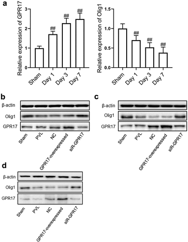 Figure 2. The expression level of GPR17 and Olig1 in PVL rats was negatively related. a. The gene expression level of GPR17 and Olig1 was detected by RT-PCR (##p < 0.01 vs. sham). b. The expression level of GPR17 and Olig1 in PVL rats on Day 1 post-modeling was determined by Western blotting. c. The expression level of GPR17 and Olig1 in PVL rats on Day 3 post-modeling was determined by Western blotting. d. The expression level of GPR17 and Olig1 in PVL rats on Day 7 post-modeling was determined by Western blotting