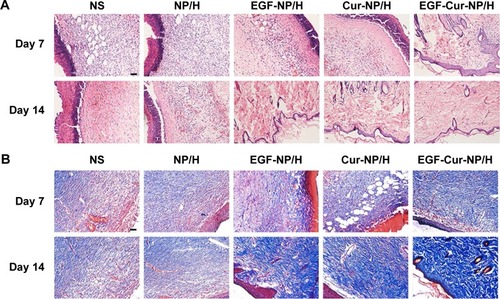 Figure 7 H&E and MT staining of the wounds.Notes: Representative images of H&E (A), and MT (B) staining of wounds treated with NS, NP/H, EGF-NP/H, Cur-NP/H, and EGF-Cur-NP/H at day 7 and 14 post-wounding. Scale bar =50 μm, magnification 20×.Abbreviations: EGF, epidermal growth factor; H&E, hematoxylin and eosin; MT, Masson’s trichrome; NP, nanoparticle; H, hydrogel; Cur, curcumin; NS, normal saline.