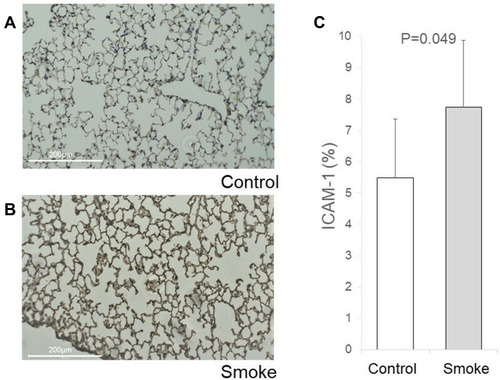 Figure 4 Immunohistochemical (IHC) staining of ICAM-1. Lung tissues from the largest longitudinal section in the right lobe of control and smoking mice were stained for ICAM-1. Anti-ICAM1 primary antibody diluted 1:100 was used for IHC staining. ICAM-1 expression was quantified by measuring the percentage area of expression (0–100%) using ImageJ. Briefly, five randomly chosen field images (0.02 × 0.01 inches) from the slide containing the maximum longitudinal section of the right lobe were acquired using a light microscope, and colors that were not of interest were removed via the replace mode. The adapted images were converted to grey scale and the area of expression was located by adjusting the threshold. The percentage area of expression is denoted by positive pixels on the labeled areas. (A) IHC staining of ICAM-1 in control mouse lung. (B) IHC staining of ICAM-1 in smoking mouse lung. (C) The ICAM-1 antibody tended to strongly stain the lungs from the smoking group (7.75 ± 3.27 vs 5.48 ± 2.1, P = 0.049).