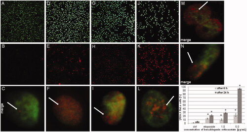 Figure 9. Bersaldegenin-1,3,5-orthoacetate induced phosphorylation of H2A.X in HeLa cells nuclei. DMSO (0.25% v/v, a negative control, A–C) and etoposide (10 μM, a positive control, D–F), and the compound were added to the cells at concentrations of 1.0 (G–I) and 5.0 μg/mL (J–L) for 24 h. (M) and (N) show HeLa nuclei after 6 h of incubation with the bersaldegenin compound at concentrations of 1 μg/mL (M) and 5 μg/mL (N). The nuclei were stained with Hoechst 33342 dye (A, D, G, J, M, N) and anti-phospho-H2A.X (Ser139) Alexa Fluor 555 conjugate antibody (B, E, H, K, M, N). Arrows indicate γH2A.X foci signals visible in the nuclei. The graph shows the γH2A.X nuclei (%) with high fluorescence signal in the controls and the treated HeLa cells. The experiment was repeated twice. Error bars indicate standard deviations. Significant differences relative to the control are marked with an ‘*’ (p < 0.05). The images were done with a fluorescence microscope at 100× and 630× magnification.