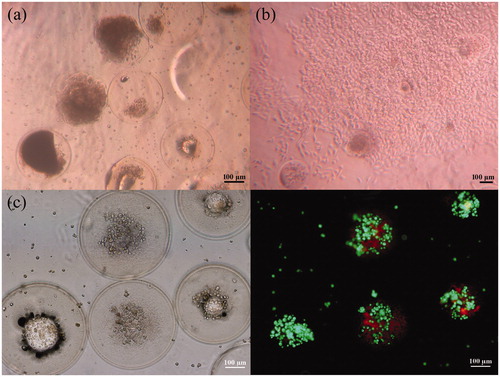 Figure 12. Representative microscopy images of cell-loaded microspheres (Qd = 20 μl/min, 107 cell/ml, 10% FBS): (a) Bright field microscopy images of cell-loaded microspheres being cultured for 20 days and vibrated slightly; (b) Bright field microscopy images of cell-loaded microspheres being cultured for 12 days, vibrated slightly and cultured for additional 1 day; (c) Live/dead micrograph of cell-loaded microspheres at day 41. Scale bar represents 100 μm.