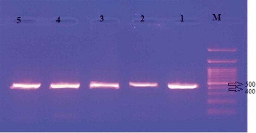 Figure 4. Gel image of cpDNA tmL-F region bands