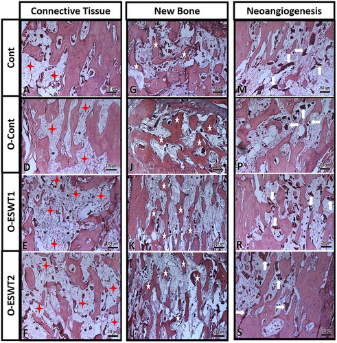 Figure 5. Histological image showing connective tissue areas of (A,D–F). The connective tissue areas are marked with red star. New bone areas have been shown in (G,J–L) images. New bone areas are marked with a white star. New vessel areas have been shown in (M,P,R,S) images. New vessel areas are marked with white (→). (original magnification ×5, hematoxylin-eosin).