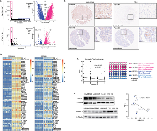 Figure 2. SIGLEC15 expression was negatively correlated with PD-L1 expression in HCC samples, relating to a barren immune microenvironment in tumor.