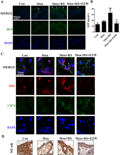 Figure 4 Effects of Erzhiwan on the MIF-CD74-NF-κB signal in experimental depigmentation mice. (A) MIF-positive expression in the skin was determined using an immunofluorescence method, and marked with white arrows. Scale bar=100 μm. (B) Plasma MIF content was detected using an ELISA method (n=6). (C) The immunofluorescence double staining was used to determine the co-localization of MIF and CD74, and the co-localization was marked with white arrows. Scale bar=25 μm. (D) Nuclear NF-κB-positive expression was detected using an immunohistochemical method, and the expression was marked with red arrows. Scale bar=50 μm. Data are expressed as mean ± SD, and compared with Mon group at ##p < 0.01, and compared with Mon+RS group at ^^p < 0.01.