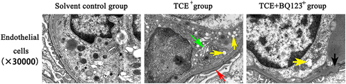 Figure 7 Glomerular endothelial cells TEM detection (×30,000). Red arrow: the fused foot processes; yellow arrow: the vacuolate degeneration of massive mitochondria; green arrow: the dilation of Golgi’s apparatus; black arrow: the slightly thickened glomerular basement membrane. Glomerular endothelial cells in solvent control group showed normal cell structure; foot processes of the podocytes appeared fused, vacuolate degeneration of massive mitochondria and dilation of Golgi’s apparatus were also observed in TCE sensitized positive mouse. Glomerular basement membrane slightly thickened, occasional vacuolate degeneration of mitochondria were seen in TCE+BQ123 sensitized positive mouse.