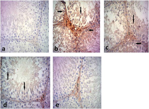 Figure 12. A photomicrograph of immunohistochemical stained sections for Caspase-3 of testes of the different groups.