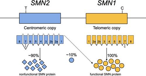 Figure 1 Two genes are responsible for producing the survival motor neuron (SMN) protein, SMN1 and SMN2. SMN1 provides humans with the proper quantity of SMN protein necessary for a normal phenotype. SMN2 is an inverted duplicate of SMN1 lying closer to the centromere. A C>T transition in exon 7 of SMN2 causes the SMN2 gene to produce mostly (~90%) nonfunctional protein and a small amount (~10%) of the functional SMN protein.