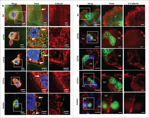 Figure 2. OS-mutants co localize with calnexin and not with E cadherin. (A) Shown are the confocal images of HaCaT cells transiently expressing TRPV3-Wt-GFP or OS-mutants. Cells were fixed within 36 hours after transfection and the cells were stained for anti Calnexin antibody. TRPV3-Wt shows discrete ER labeling and TRPV3 localization on membrane, while OS mutants shows co localization with ER (Merge image) suggesting that OS mutants have reduced surface expression and are primarily retained in ER. (B) Immunolocalization of TRPV3-Wt-GFP and OS mutants with membrane marker E cadherin is shown. TRPV3-Wt-GFP shows proper E cadherin labeling and proper TRPV3 localization on membrane, while OS mutants are not localize on the membrane. In most cases, cells expressing OS-mutants have much reduced E cadherin staining (T and NT represent transfected and non-transfected cells respectively). Scale bar is 10µm and 5µm for merge and zoom images.