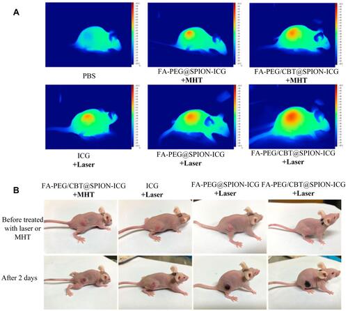 Figure 6 Thermal imaging of the mice after treatment with different formulations with NIR or MHT (A). Imaging was performed before and on day 2 after administering the different treatments (B). Reproduced from Zhong Y, Bejjanki NK, Miao X et al. Synthesis and Photothermal Effects of Intracellular Aggregating Nanodrugs Targeting Nasopharyngeal Carcinoma. Frontiers in bioengineering and biotechnology. 2021: 847. Creative Commons license and disclaimer available from: http://creativecommons.org/licenses/by/4.0/legalcode.Citation85