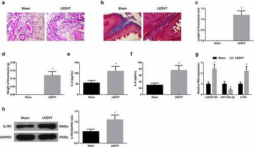 Figure 1. LINC01123 and IL1R1 are elevated while miR-125a-3p is silenced in LEDVT rats. (a): HE staining assessment of pathological conditions; (b): Masson staining evaluation of pathological conditions; (c-d): Length and weight of thrombus; (e-f): Inflammatory cytokines IL-6 and IL-8 in the serum; (g-h): RT-qPCR or Western Blot examination of LINC01123, miR-125a-3p and IL1R1. Values are expressed as mean ± standard deviation (n = 6). * Vs. the Sham, P < 0.05.