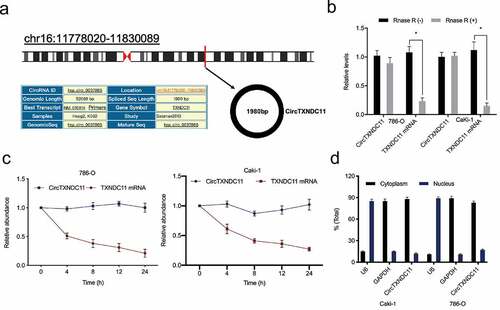 Figure 1. Characteristics of circTXNDC11 in RCC