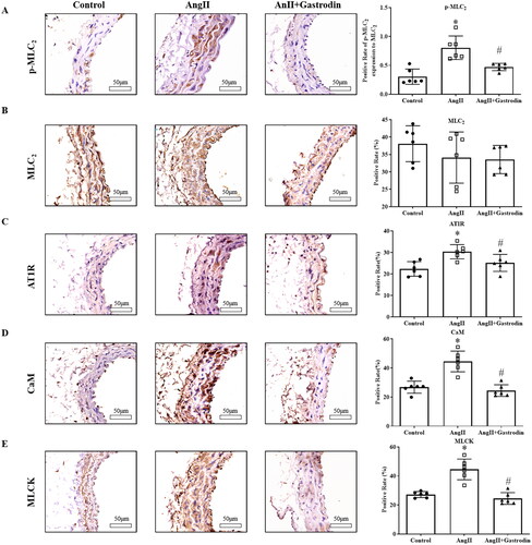 Figure 5. Expression of proteins involved in the MLCK/p-MLC2 pathway in abdominal aorta tissues. Immunohistochemical (IHC) staining was used to detect protein levels of (A) phospho-myosin light chain 2 (p-MLC2), (B) myosin light chain 2 (MLC2), (C) angiotensin type 1 receptor (AT1R), (D) calmodulin (CaM) and (E) myosin light chain kinase (MLCK) in abdominal aorta tissues. Images were taken at a magnification of ×400. All values are represented as mean ± SD; *p < 0.05 Ang II vs. control group; #p < 0.05 Ang II + gastrodin vs. Ang II group.