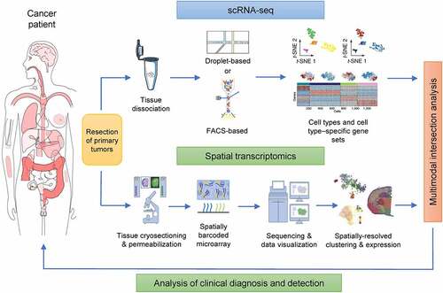 Figure 6. Multimodal intersection of scRNA-seq and spatial transcriptomic analysis of tumors from patients. The scRNA-seq and spatial transcriptomics of surgically resected tumor samples were conducted in parallel. The cell types of each cluster were determined through the use of specific stains. Spatial transcriptomics was performed after the remaining tissue had been cryosectioned, wherein each spot corresponded to a location in the tissue in which the transcriptomes had been collected. When applied to the two datasets, multimodal intersection analyses revealed the spatial distribution of cell populations and subpopulations.