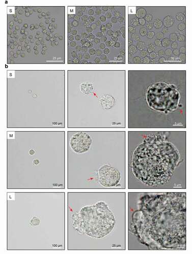 Figure 3. Microscopic assessment of cell membrane morphology of PFFs of different sizes. A. The different degrees of cell membrane roughness of small (s), medium (m) and large (l) cells as assessed by microscopy. B. The cell membrane of small (S), medium (M) and large (L) cells under 10×, 40× and 100× microscopy. The red arrows represent irregular parts of cells