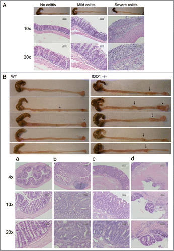 Figure 4 IDO deficiency accentuates the effects of inflammatory insults that promote colon carcinogenenesis. (A) Colitis induction. Colons from WT and IDO-/- mice treated 3 d with 3% DSS in drinking water were fixed in paraffin and processed for H&E staining. Representative examples scored for no colitis, mild colitis and severe colitis are shown at original magnifications of 10× (middle) or 20× (bottom). (B) Colon carcinogenesis. WT and IDO-/- mice were treated once i.p. with 20 mg/kg DMH and then 7 d 2% DSS in drinking water followed by normal drinking water to an endpoint of 18 wks. Colons were harvested from euthanized mice, fixed in paraffin and processed for H&E staining. Representative images of gross pathology in WT or IDO-/- mice (top panels) illustrate observations of macroscopic tumors (arrows) or prolapsed rectums (arrowheads). Representative images of histopathology in IDO-/- mice (bottom panels) illustrate observations of (a) no tumor, (b) mucosal invasion, (c) submucosal invasion and (d) muscular invasion. Original magnifications are 4× (top), 10× (middle), 20× (bottom).