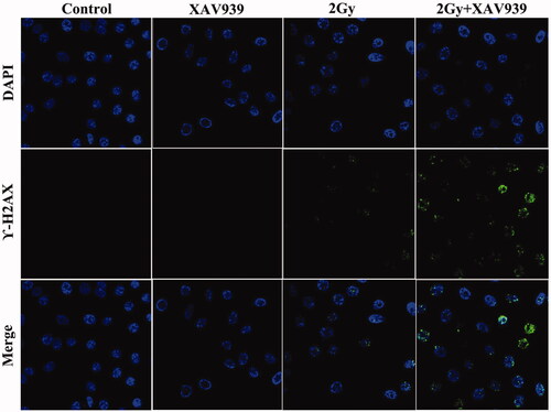 Figure 5. XAV939 enhanced DNA damage in irradiated HeLa cells. Immunofluorescence staining for γ-H2AX phosphorylation in HeLa cells after carbon ion beam alone or in combination with XAV939 at 6 h.