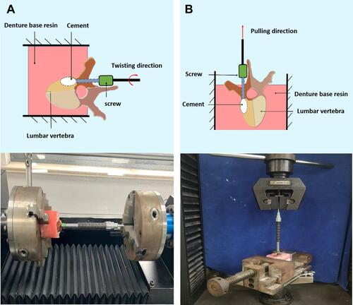 Figure 3 Biomechanical testing of cemented cortical bone trajectory screws.