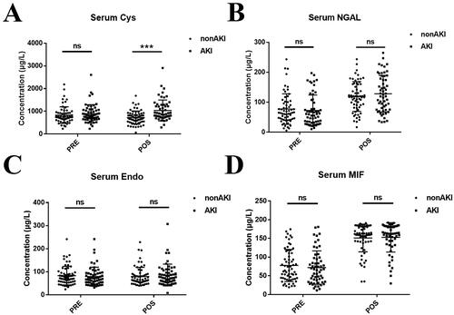 Figure 2. Novel biomarkers for AKI after LT. (A) serum cystatin C concentration, (B) serum NGAL concentration, (C) serum endostatin concentration and (D) serum MIF concentration. Abbreviations: AKI: acute kidney injury; NGAL: neutrophil gelatinase-associated lipocalin; MIF: macrophage migration inhibition factor; PRE: preoperative; POS: postoperative. ns: not statistically significant, ***p-value < 0.001.
