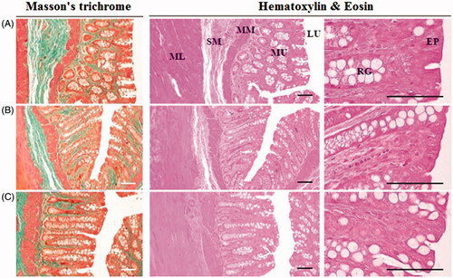 Figure 4. Morphology of the rat rectums: (A) control, (B) DRTN, (C) hydrogel. A simple microscope was used to investigate the rectum partitions with special emphasis on epithelium (EP), lumen (LU), rectal gland (RG), submucosa (SB), muscularis mucosa (MM) and mucosal layer (ML). Ruler bars = 120 μm.
