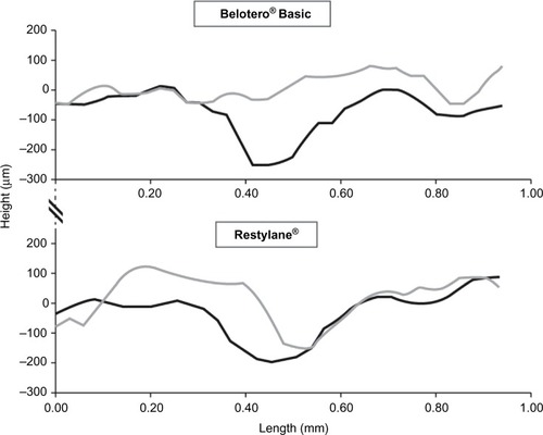 Figure 1 Two-dimensional surface profiles before (black lines) and 4 weeks after treatment (gray lines) with Belotero® Basic and Restylane®.