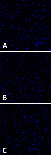 Figure 12. Anti-JNK1 immünostaining. Saline (A), Sham (B) and US (C) groups respectively are stained with anti- JNK1 antibody. None of the sections of NA region within all groups included positive cells. Nuclei are stained with DAPI (blue), ×40 oil-immersion lens.