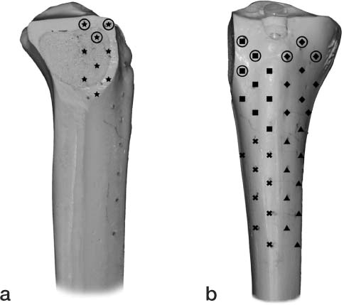 Figure 1. Lateral view (panel a) and anterior view (panel b) of the tibia showing marker placement in the reference segment. ★ segment A, ▪ segment B, ♦ segment C, ▴ segment D, × segment E, ○ segment F.