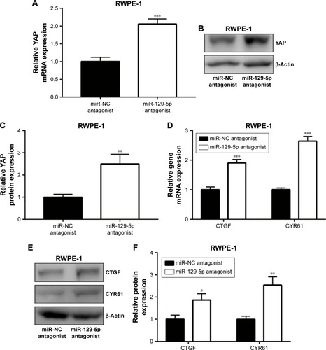 Figure 6 MiR-129-5p downregulation elevated YAP and its target gene expression in RWPE-1 cells.Notes: (A) MiR-129-5p downregulation increased YAP mRNA level in RWPE-1 cells. (B) Western blot showed that YAP protein level was elevated toward miR-129-5p downregulation. (C) Quantitative analysis of YAP protein level in (B). (D) MiR-129-5p downregulation increased CTGF and CYR61 mRNA levels in RWPE-1 cells. (E) Western blot showed that CTGF and CYR61 protein levels were elevated toward miR-129-5p downregulation. (F) Quantitative analysis of CTGF and CYR61 protein levels in (E). *P<0.05, **P<0.01, ***P<0.001.