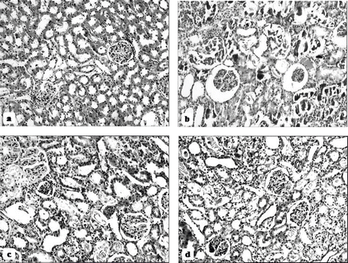 Figure 7. Hematoxylin and eosin-stained sections of rat kidneys (original magnification × 100). (a) Kidney section of a control rat showing normal architecture. (b) Kidney section of a glycerol + saline-treated rat (ARF group) showing severe tubular necrosis and cast formation. (c) Kidney section of a glycerol + L-carnitine-treated rat, where L-carnitine was started at the same time as the glycerol injection (ARF-LC group). The level of tubular necrosis and cast formation has decreased compared with the ARF group. (d) Kidney section of a glycerol + L-carnitine treated rat, where L-carnitine was started 48h before glycerol injection (ARF-proLC group). The level of tubular necrosis and cast formation has decreased compared with the ARF and ARF-LC groups.