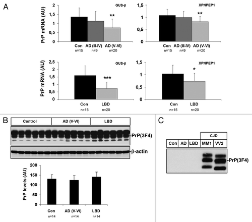 Figure 5. Expression of PrP in frontal cortex in AD and LBD. (A) mRNA average expression levels of PrP in the frontal cortex of control, AD (III-IV), AD (V-VI) and LBD cases, as determined by TaqMan PCR assays. Values for PrP mRNA are normalized using GUSβ and XPNPEP1 as internal controls. Reduced PrP mRNA levels are seen in AD (V-VI) and LBD. (B) western blot analysis of PrP in the frontal cortex of control and AD (III-IV), AD (V-VI) and LBD cases. Five representative cases are shown; β-actin is used to normalize total protein loaded onto the gel. Densiometric values of all the cases analyzed by western blot: control (n = 14), AD (III-IV) (n = 14), AD (V-VI) (n = 14) and LBD (n = 14) reveals no differences in PrP expression levels between control and diseased cases. *P > 0.05; **P > 0.01; ***P > 0.001: control vs AD/LBD cases. AU: arbitrary units. (C) PK digestion of AD and LBD samples confirms that AD and LBD do not contain PrPsc.