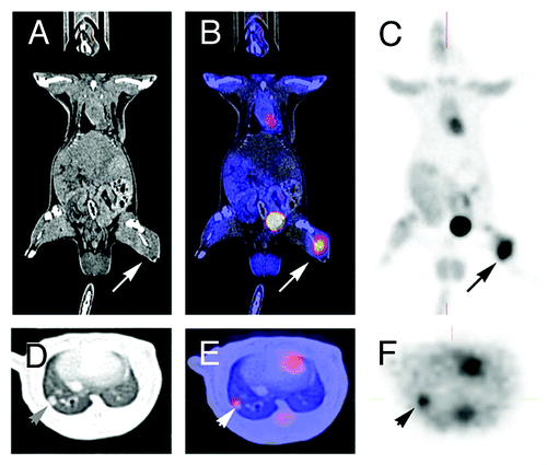 Figure 1. PET-imaging and CT-scan leading to fusion images and allowing early detection of metastasis. A rat grafted with an osteosarcoma (no image from a metastatic breast cancer was available) in the left leg was explored by a by regular CT-Scan (A, D) by a PET-Scan technique (C, F). The images (B, E) were obtained by superposition of A and B, and D and F, respectively. A 3 mm metastasis (arrow) is detected in the lung both by CT-Scan and PET-imaging. Modern imaging techniques allow the early detection of metastasis, the measurement of metabolic activity of the primary cancer and of metastases, and the fusion of images obtained with different modalities. They allow the staging according to RECIST criteria.Citation104