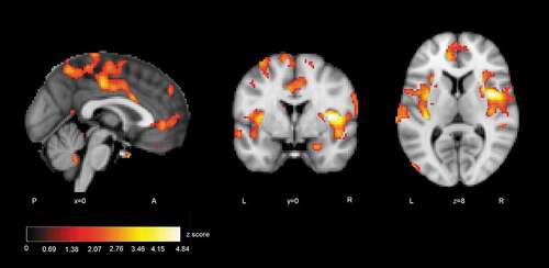 Figure 4. ISC group comparison (control > autistic, p < .05, FDR uncorrected)