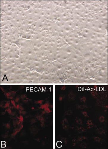 Figure 1.  Characterization of mouse aortic endothelial cells (MAECs) from heme oxygenase (HO-1) +/− mice.(A) Differential interference contrast microscopy of a confluent monolayer of MAECs while in plastic tissue culture dishes. (B) Subconfluent MAECs grown on glass cover slips were stained with an endothelial surface marker, platelet endothelial cell adhesion molecule-1 (PECAM-1), using anti-CD31 antibody (primary) and a Cy3-labeled secondary antibody. (C) Uptake of DiI-Ac-LDL in subconfluent MAECs grown on glass cover slips. DiI-Ac-LDL, 1,1′-dioctadecyl-1,3,3,3′,3′-tetramethyl-indocarbocyanine-acetylated lowdensity lipoprotein.