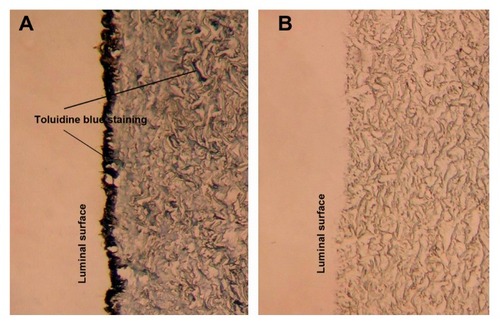 Figure 4 Toluidine blue staining of scaffolds (200×). (A) Toluidine blue staining shows the outer and middle layers of BJV scaffolds modified by heparin/DHI stained by toluidine blue, with the outer layer stained more deeply than the middle layer. The arrows indicate positive staining. (B) Toluidine blue staining shows that the unmodified BJV scaffolds could not be stained by toluidine blue.Abbreviations: BJV, bovine jugular vein; DHI, dihydroxy-iron.