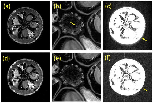 Figure 7. (a) A 2D cross-section selected from a 3D image dataset (512 × 512 × 64 voxels) of a kumquat acquired with a 3D spin-echo sequence (TR/TE = 800 ms/20 ms) at 4.74 T using the analog transceiver. (b) The central part of the image (a). (c) The cross-section of (a) with a narrow display window. (d) A 2D cross-section selected from a 3D image dataset of the kumquat acquired with the digital transceiver under the same condition as (a). (e) The central part of the image (d). (f) The cross-section of (d) with a narrow display window