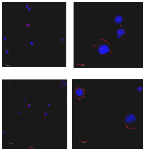 Figure S8. Laser-scanning confocal microscopy of mouse B16F10 melanoma cells after 10 (top) and 60 (down) minutes of incubation with HFt rhodamine-labeling.Notes: Clusters of HFt-based nanoparticles with rhodamine fluorescence appear in red. Original magnification 40× (left) and zoom 3× (120×, right) were used.Abbreviations: HFt, human protein ferritin; MSH, melanocyte-stimulating hormone peptide.