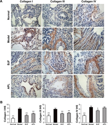 Figure 10 Effect of Bufei Jianpi formula (BJF) and aminophylline (APL) on the expression of collagens I, III, and IV in the lung obtained from chronic obstructive pulmonary disease (COPD) rats.