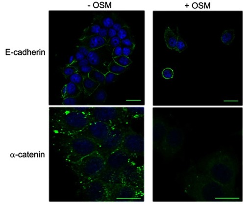 Figure S1 OSM induces an EMT in MCF-7 cells. MCF-7 breast tumor cells were treated with OSM (25 ng/mL) for 72 hrs. OSM induces an increased mesenchymal phenotype, a redistribution in E-cadherin expression (green, upper panels scale bar-20 nm), and a slight decrease in α-catenin expression (green, lower panels scale bar-20 nm), as measured by immunofluorescence (DAPI = blue).