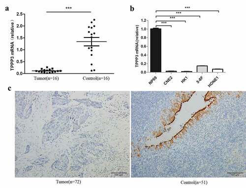 Figure 2. Expression of TPPP3 is reduced in NPC tissues and cell lines