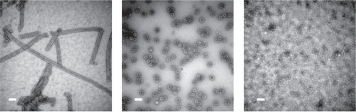 Figure 5 SV40 can form spherical or tubular structures depending on buffer conditions. Left: SV40VP1 pentamers assembled into tubular structure in vitro. Middle: SV40VP1 pentamers assembled into 40 nm spherical particles in vitro in the presence of DNA. Right: VP1 assembled into VLPs (Virus Like Particles) inside insect cells. In all cases, scale bar is 100 nm. Images courtesy of Hiroko Tsukamoto.