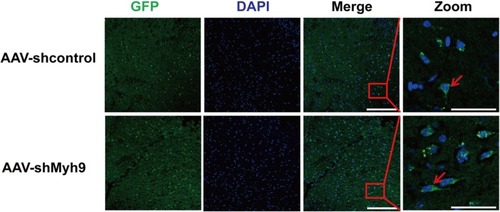 Figure 1 Confocal photomicrographs of GFP expression 4 weeks following injection of AAV-shMyh9. Brain sections from C57BL/6J mice 4 weeks after intravenous injection of AAV9-control-GFP or AAV9-sh NMMHC IIA-GFP (1.5×1011 genome copies/mouse). Bar: 50 µm. The red arrows indicate GFP-positive cells.