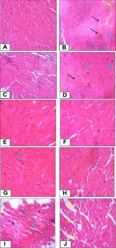 Figure 2 Histopathological changes of cardiac tissue of control and experimental rats.