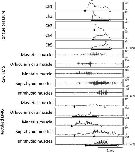 Figure 2. A typical example of tongue pressure waveforms, raw and rectified waveforms of orofacial muscle activities during swallowing.