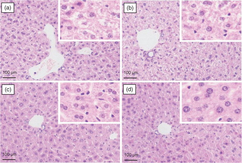 Fig. 5 The effect of spinach nitrate on histopathological changes of liver hepatocytes stained with H&E in high-fat and high-fructose fed mice: (a) model group (0 mg/kg), (b) low-dose group (15 mg/kg), (c) medium-dose group (30 mg/kg), and (d) high-dose group (60 mg/kg).