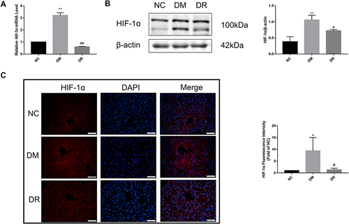 Figure 5 HIF-1α mRNA and protein levels in the livers of all groups. (A) Hif-1α mRNA level in the liver was detected by real-time PCR. (B) HIF-1α protein level in the liver was detected by immunofluorescence. Magnification, 400×; scale bar=50μm. (C) HIF-1α protein level in the liver was detected by Western blot. Experiments were performed at least thrice with similar results. *P < 0.05, **P < 0.01 vs NC group; #P < 0.05, ##P < 0.01 vs DM group.