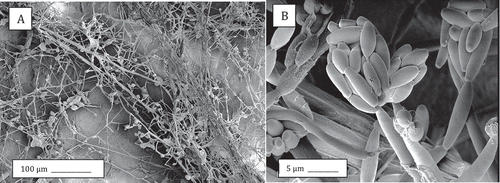 Fig. 7 Scanning electron microscopy images of crown tissues inoculated with F. oxysporum. (a) Mycelium and spore clusters; (b) Close-up of microconidia in a cluster on a phialide.