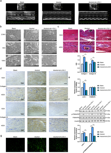 Figure 2. Knockdown of LOX-1 ameliorates myocardial fibrosis in alcoholic cardiomyopathy rats in vivo. (a) The UCG images of three groups of rats. (b) The cardiac tissues were observed by TEM under 2.5KX, 5KX and 10KX magnification. Scale bars: 2 μm, 2 μm and 1 μm. (c) Collagen deposition in rats’ cardiac tissues was shown by Masson staining under 100X and 400X magnification. Scale bars: 100 μm and 25 μm. (d) The levels of collagen I and III were detected using IHC under 100X and 400X magnification. Scale bars: 100 μm and 25 μm. (e) The relative expression levels of mRNAs in rats’ cardiac tissues were analyzed by RT-qPCR. (f) The relative expression levels and phosphorylation levels of proteins in rats’ cardiac tissues were assessed by western blot. (g) The ROS level was detected using DCFH-DA assay. Scale bars: 100 μm.*: P < 0.05 and **: P < 0.01.