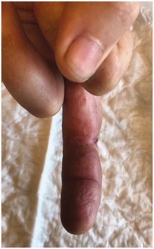 Figure 11. Skin appearence after 15 weeks of treatment.