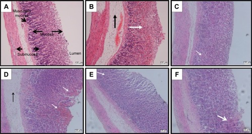 Figure 3 Histological evaluation.